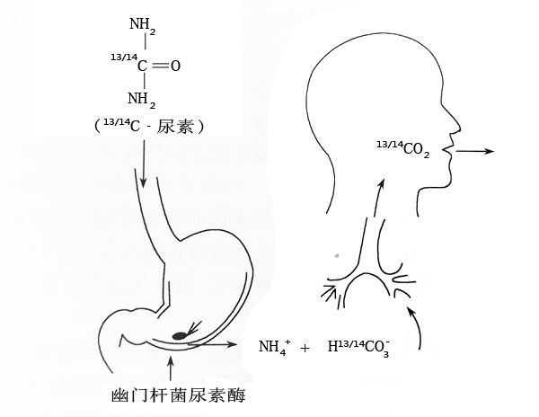 国内14C-尿素呼气试验的发展史