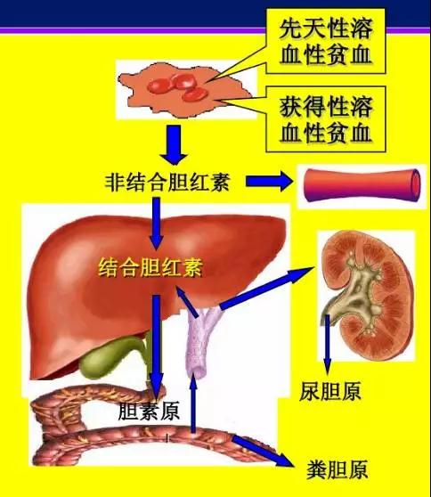 红细胞寿命测定在间接胆红素升高原因判断中的应用3