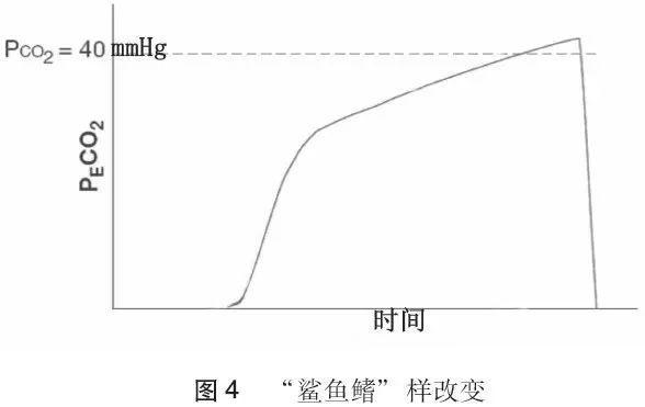 呼气末二氧化碳监测，为啥这么重要？1