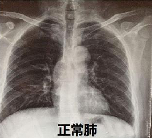 5.png 图片