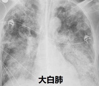 4.png 图片